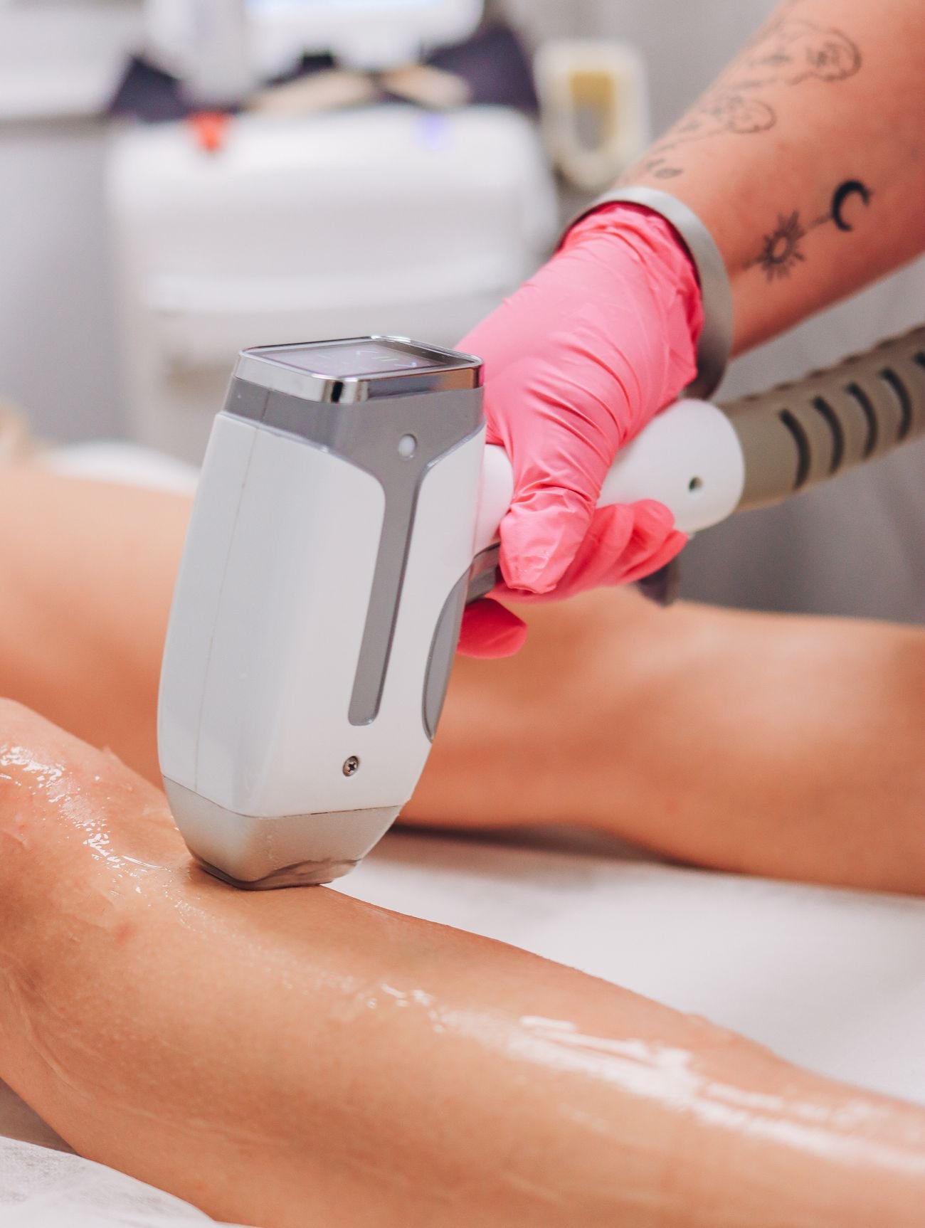 Depilación SHR en Cosmeclinic Las Condes