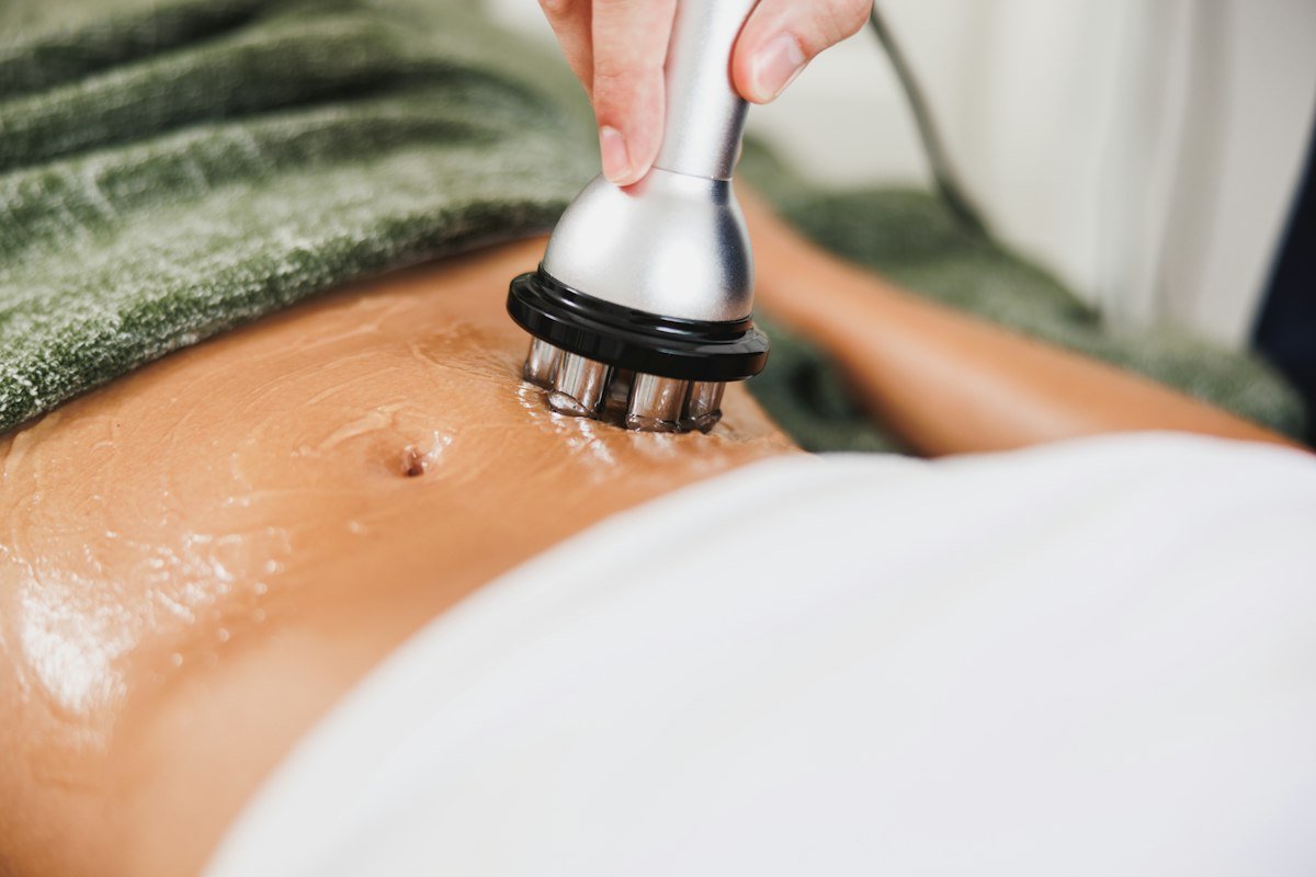 Radiofrecuencia multipolar corporal aplicada en el abdomen