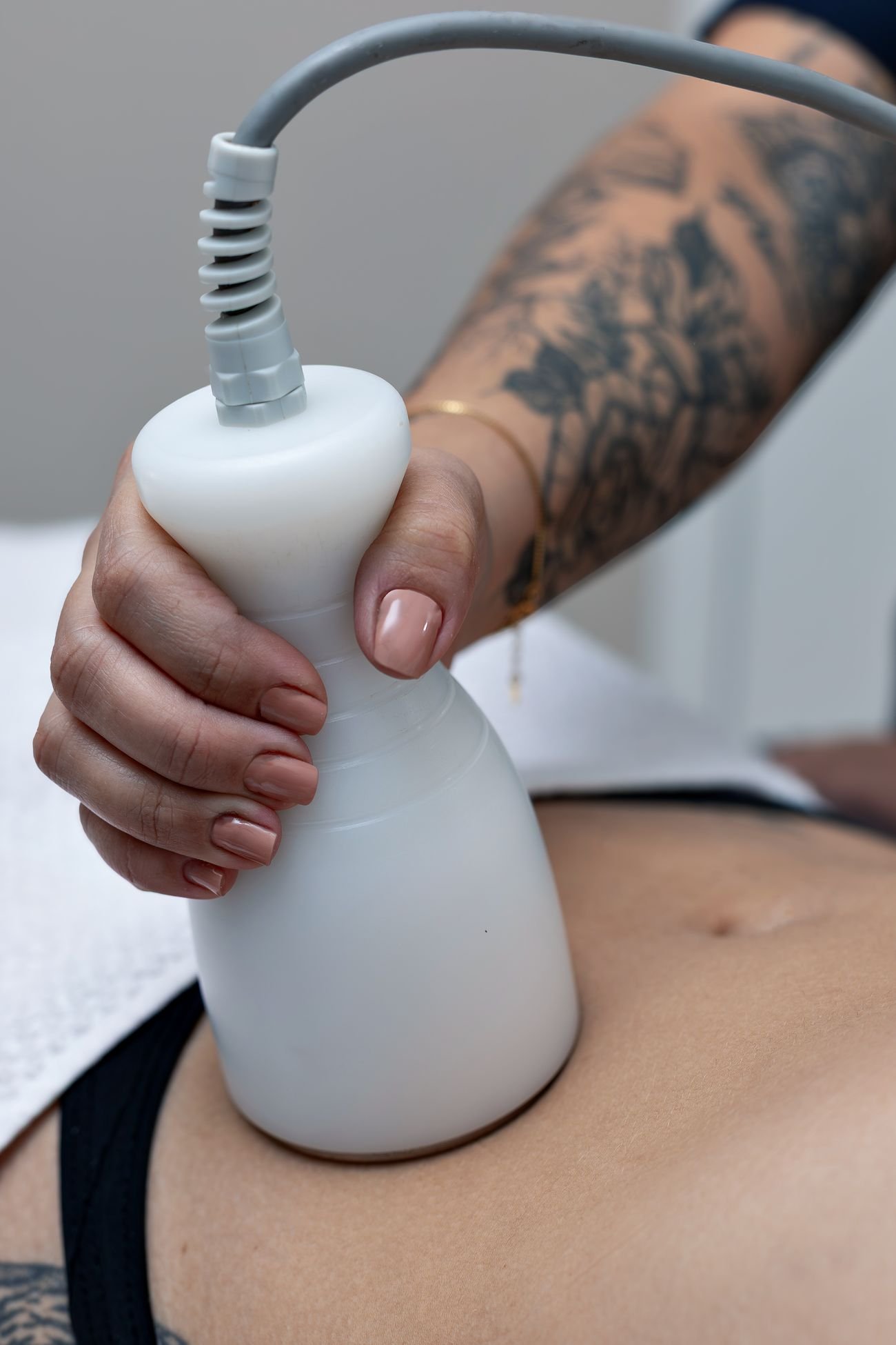 Ultracavitación en Cosmeclinic Las Condes